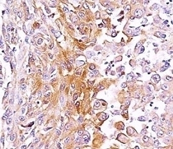 gp100 Antibody [SPM286]