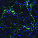 <strong>Figure 5 Immunofluorescence Validation of hRIP3 in Human Breast Tissue</strong><br>Immunofluorescent analysis of 4% paraformaldehyde-fixed human breast tissue labeling hRIP3 with 8963 at 20 μg/mL, followed by goat anti-rabbit IgG secondary antibody at 1/500 dilution (green) and DAPI staining (blue).