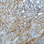<strong>Figure 9 Immunohistochemistry Validation of hRIP3 in Human Colon Tissue</strong><br> Immunohistochemical analysis of paraffin-embedded human colon tissue using anti-hRIP3 antibody (8963) at 2 μg/ml. Tissue was fixed with formaldehyde and blocked with 10% serum for 1 h at RT; antigen retrieval was by heat mediation with a citrate buffer (pH6). Samples were incubated with primary antibody overnight at 4°C. A goat anti-rabbit IgG H&L (HRP) at 1/250 was used as secondary. Counter stained with Hematoxylin.