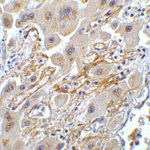 <strong>Figure 7 Immunohistochemistry Validation of hRIP3 in Human Liver Tissue</strong><br> Immunohistochemical analysis of paraffin-embedded human liver tissue using anti-hRIP3 antibody (8963) at 5 μg/ml. Tissue was fixed with formaldehyde and blocked with 10% serum for 1 h at RT; antigen retrieval was by heat mediation with a citrate buffer (pH6). Samples were incubated with primary antibody overnight at 4°C. A goat anti-rabbit IgG H&L (HRP) at 1/250 was used as secondary. Counter stained with Hematoxylin.