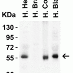 <strong>Figure 2 Western Blot Validation in Human Tissues</strong><br>Loading: 15 μg of lysates per lane.Antibodies: hRIP3, 8963 (1 μg/mL), 1h incubation at RT in 5% NFDM/TBST.Secondary: Goat anti-rabbit IgG HRP conjugate at 1:10000 dilution.