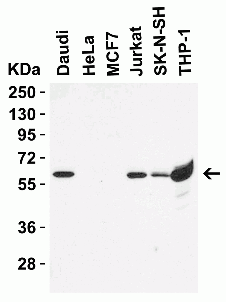 hRIP3 Antibody