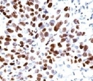 p21 Antibody [CIP1/823]