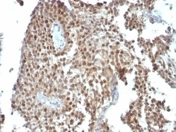 p21 Antibody [SPM306]