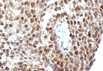 p53 Antibody [SPM590]