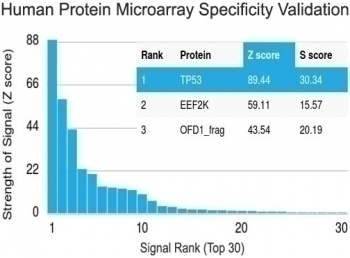 p53 Antibody [TRP/816]