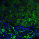 Immunofluorescence of p53DINP1 in human liver tissue with p53DINP1 antibody at 5 μg/ml. <br><br>Green: p53DINP1 antibody (3045) <br> Red: Phylloidin staining<br> Blue: DAPI staining