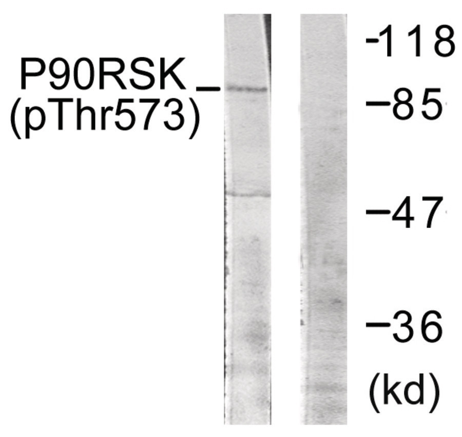 p90 RSK (phospho Thr573) Antibody