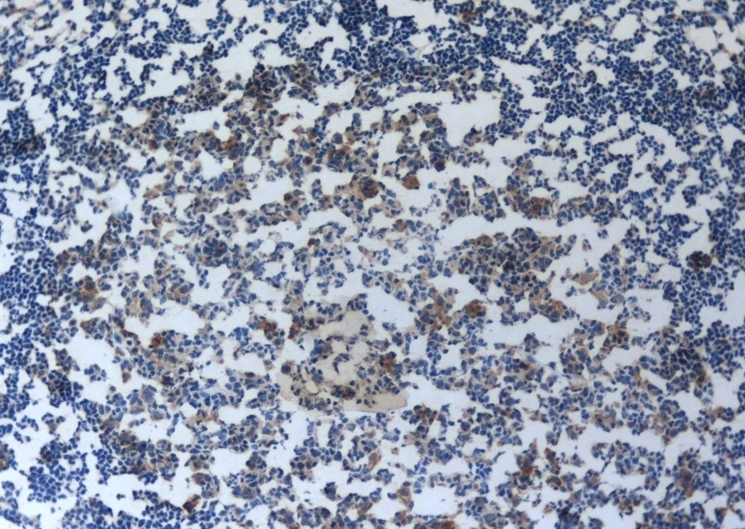 sIL-2Ra Antibody [SB-647]