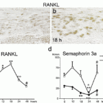 <strong>Figure 6 Immunohistochemistry and Induced Expression Validation of sRANK-L in Rat Osteogenic Compartment (Hassan et al., 2017) </strong><br>Protein analysis for sRANK-L  by immunohistochemistry with anti-sRANK-L  antibodies (3963) in rat osteogenic cells.  Strong immunoreactivity  is shown for sRANK-L  in osteogenic cells at 18hr after upper jaw molar extraction as compared to baseline.