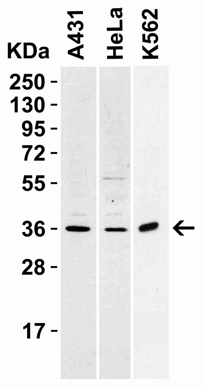 sRANK Ligand Antibody