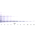 To detect hsRANKL by Western Blot analysis this antibody can be used at a concentration of 0.1 - 0.2 ug/ml. Used in conjunction with compatible secondary reagents the detection limit for recombinant hsRANKL is 1.5 - 3.0 ng/lane, under either reducing or non-reducing conditions.