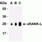 <strong>Figure 3 Western Blot Validation with Recombinant Protein</strong><br>Loading: 30 ng of human sRANK-L  recombinant protein per lane.Antibodies: sRANK-L 3963 (A: 1 μg/mL, B: 2 μg/mL and C: 4 μg/mL), 1h incubation at RT  in 5% NFDM/TBST.Secondary: Goat anti-rabbit IgG HRP conjugate at 1:10000 dilution.Observed at around 27kD.