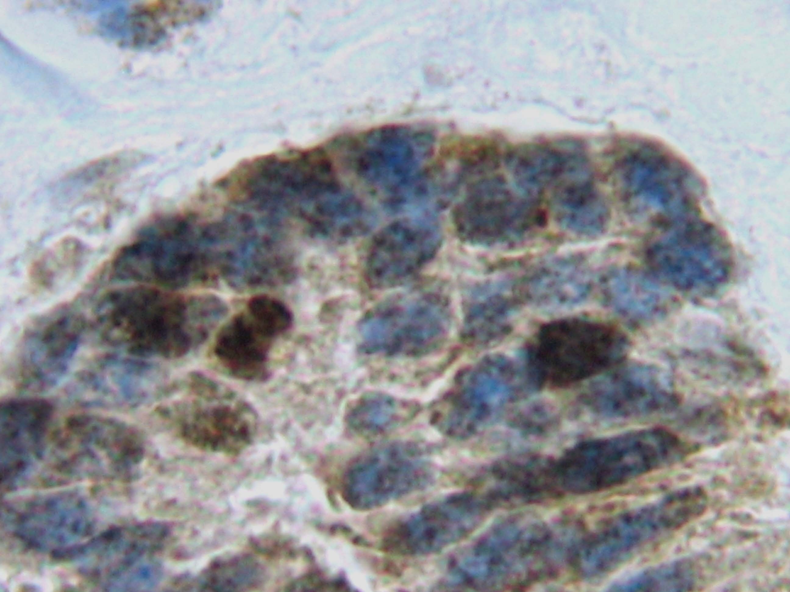 sRank Receptor Antibody