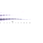 To detect hsTNF-receptor by Western Blot analysis this antibody can be used at a concentration of 0.1- 0.2 ug/ml. Used in conjunction with compatible secondary reagents the detection limit for recombinant hsTNF-receptor is 1.5-3.0 ng/lane, under either reducing or non-reducing conditions.