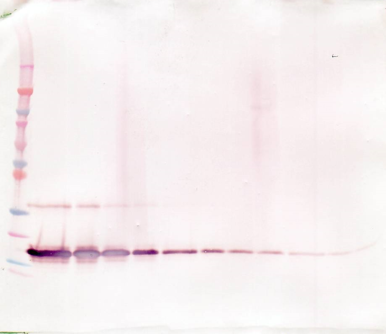 sTNF-receptor II Antibody