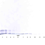 To detect hsTRAIL Receptor-2 by Western Blot analysis this antibody can be used at a concentration of 0.1 - 0.2 ug/ml. Used in conjunction with compatible secondary reagents the detection limit for recombinant hsTRAIL Receptor-2 is 1.5 - 3.0 ng/lane, under either reducing or non-reducing conditions.
