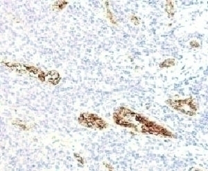 von Willebrand Factor Antibody [WFA52-2]