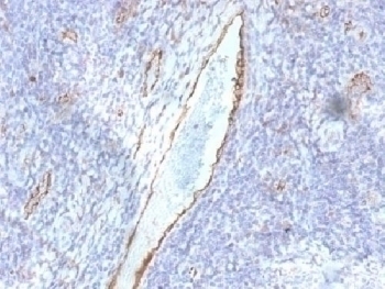 von Willebrand Factor / vWF Antibody [F8/86]