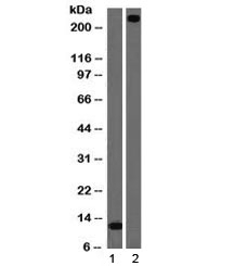 von Willebrand Factor / vWF Antibody [VWF/1465]