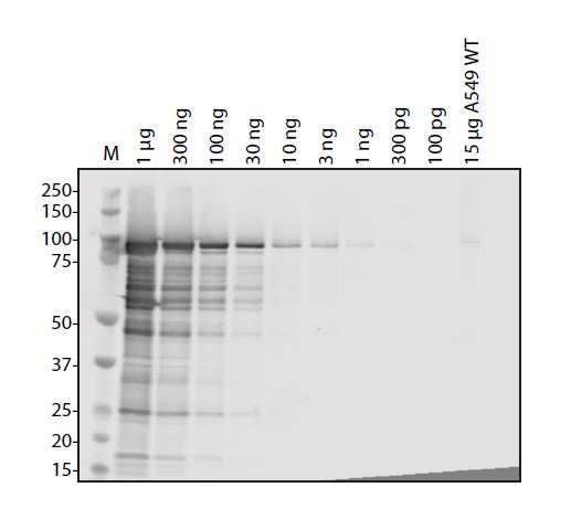 Human Coronavirus 229E Nucleocapsid Antibody