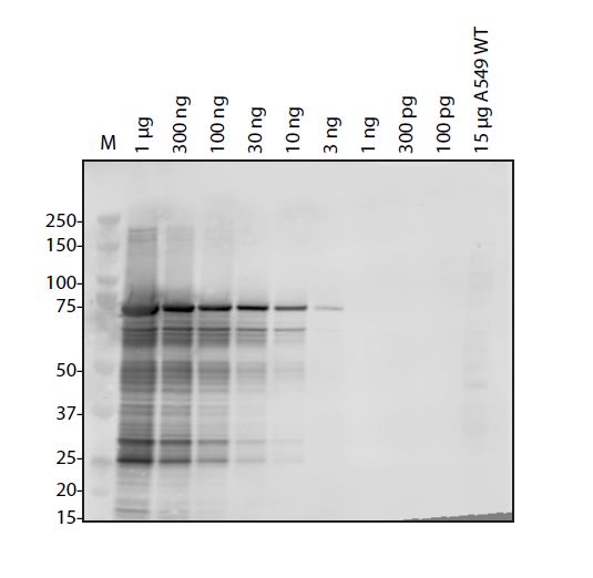 Human Coronavirus OC43 Nucleocapsid Antibody