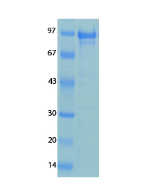 Human Coronavirus OC43 Recombinant Protein