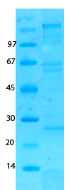 MERS Coronavirus spike (HSZ-Cc) Recombinant Protein