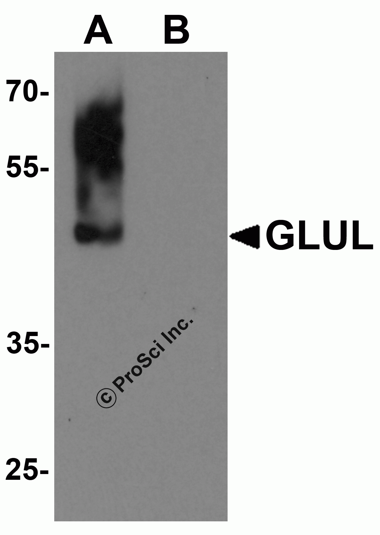 GLUL Monoclonal Antibody