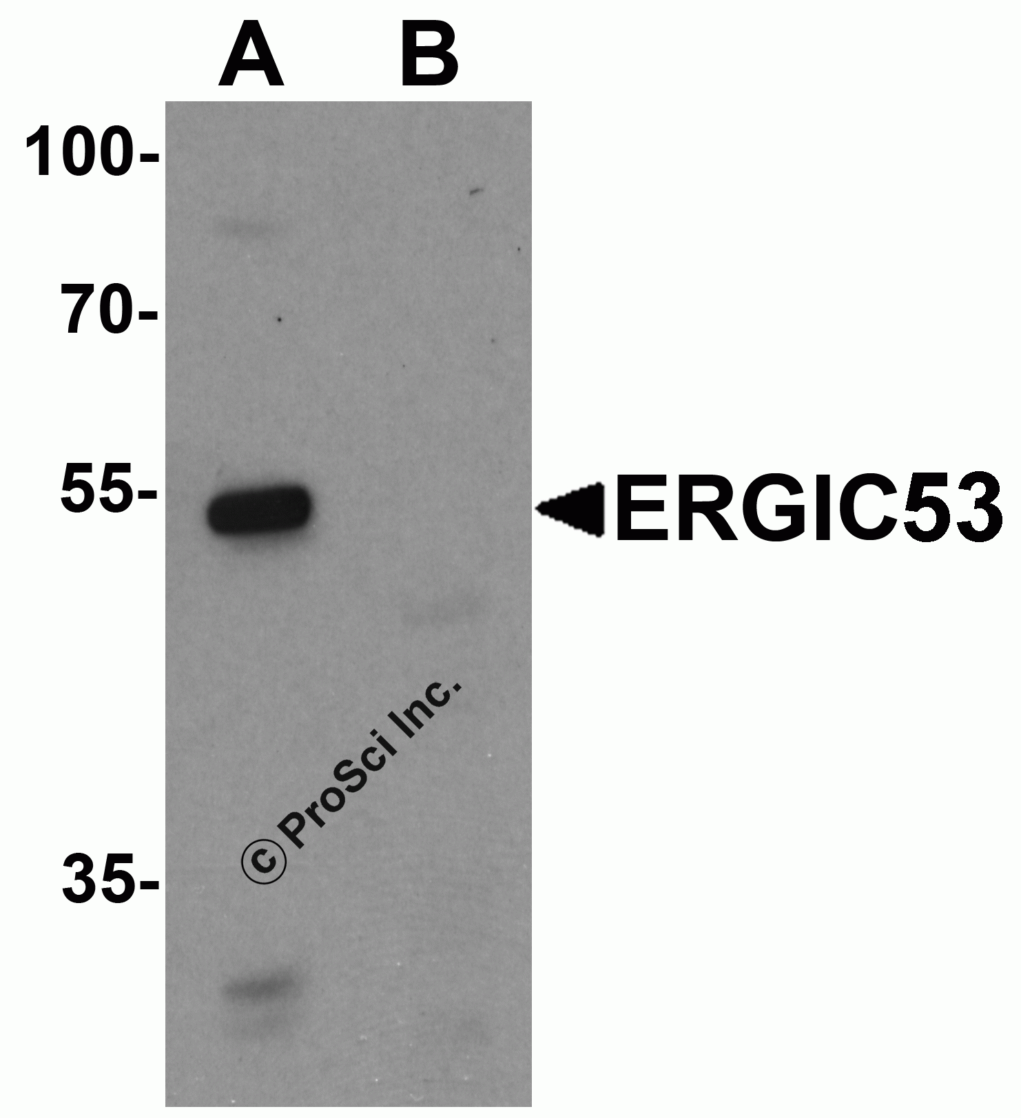 ERGIC53 Monoclonal Antibody