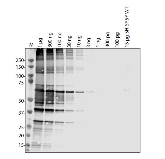SARS-CoV-2 (COVID-19) Membrane Antibody