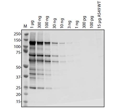 SARS-CoV-2 (COVID-19) NSP11 NSP12 Antibody