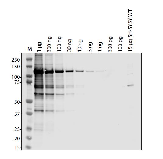 SARS-CoV-2 (COVID-19) NSP13 Antibody