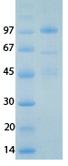 SARS-CoV-2 (COVID-19) NSP14 Recombinant Protein