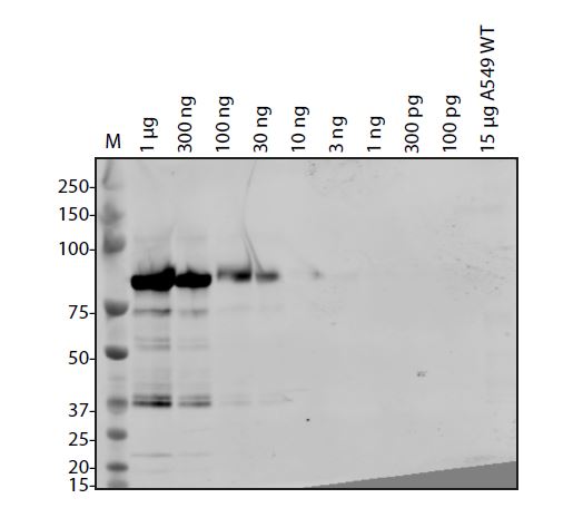SARS-CoV-2 (COVID-19) NSP15 Antibody