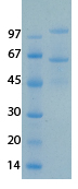 SARS-CoV-2 (COVID-19) NSP15 Recombinant Protein