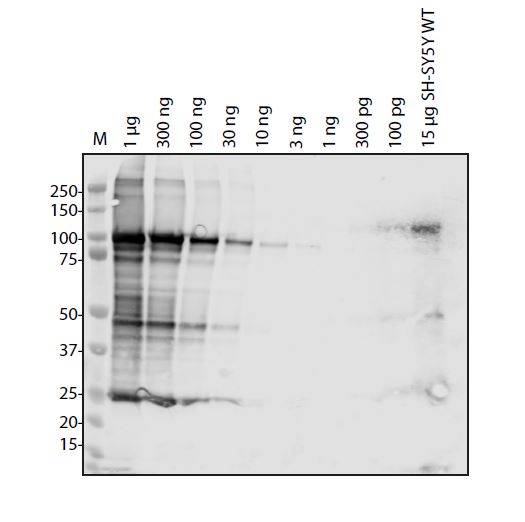 SARS-CoV-2 (COVID-19) NSP2 Antibody