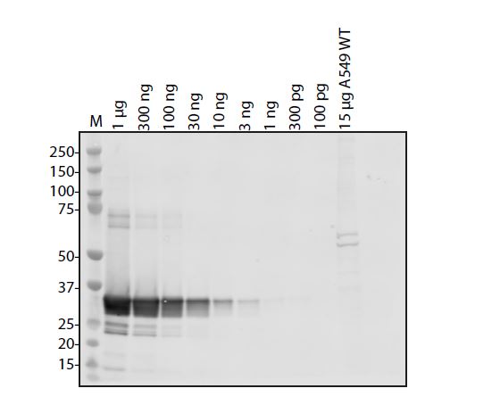 SARS-CoV-2 (COVID-19) NSP7 Antibody
