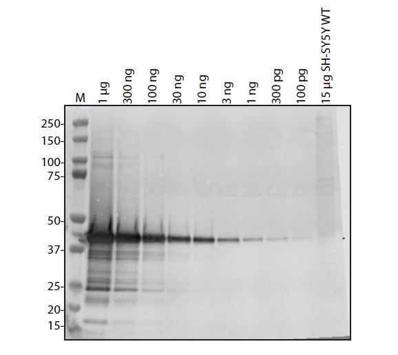 SARS-CoV-2 (COVID-19) NSP8 Antibody
