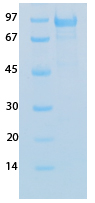 SARS-CoV-2 (COVID-19) Nucleocapsid Recombinant Protein