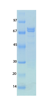 SARS-CoV-2 (COVID-19) Nucleocapsid Recombinant Protein