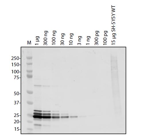 SARS-CoV-2 (COVID-19) ORF10 Antibody