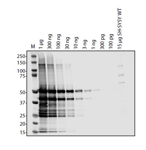 SARS-CoV-2 (COVID-19) ORF3A Antibody