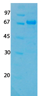 SARS-CoV-2 (COVID-19) ORF3A Recombinant Protein