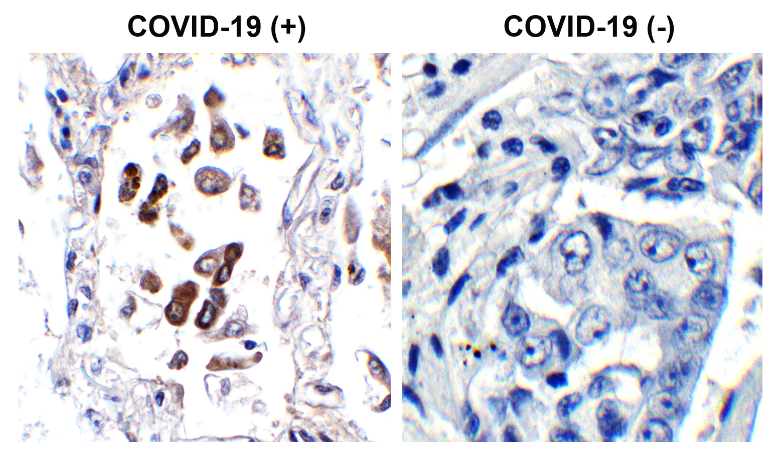 SARS-CoV-2 (COVID-19) ORF8 Antibody