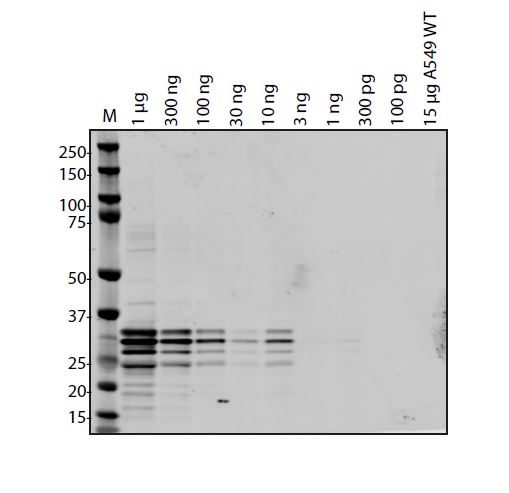 SARS-CoV-2 (COVID-19) ORF7A Antibody