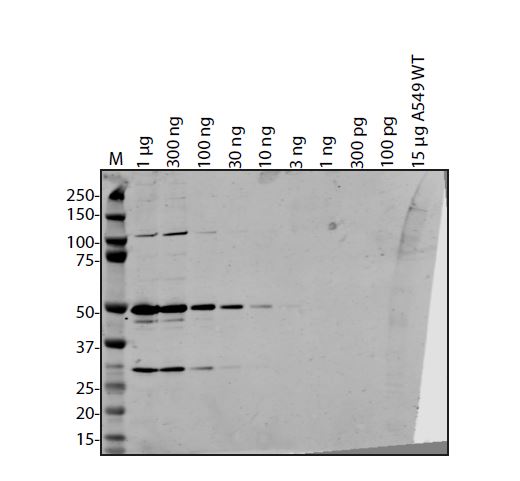 SARS-CoV-2 (COVID-19) ORF7B Antibody