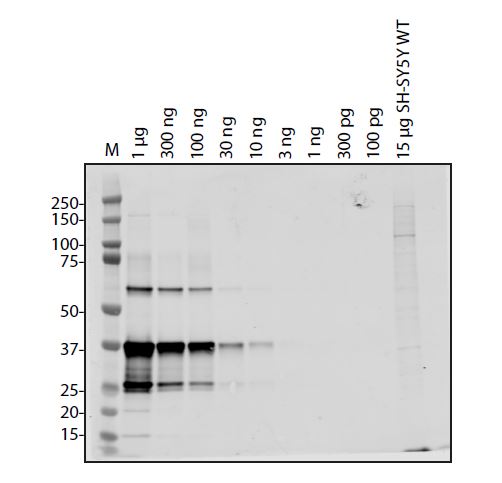 SARS-CoV-2 (COVID-19) ORF8 Antibody
