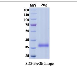 SARS-CoV-2 (COVID-19) Delta Variant (B.1.617.2) Spike RBD (L452R, T478K) Recombinant Protein