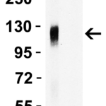 <strong>Figure 2 WB Validation of Spike 681P Antibodies with SARS-CoV-2 Spike S1 Protein </strong><br>Loading: 30 ng of SARS-CoV-2 spike S1 proteins: WT and alpha variant (B.1.1.7, UK).Detection Antibodies: SARS-CoV-2 Spike 681P antibody, PM-9367, 1 μg/mL, incubated at RT for 1 hr.Secondary Antibodies: Goat anti-mouse HRP at 1:5,000, incubated at RT for 1 hr.<strong>SARS-CoV-2 spike 681P antibody (PM-9367) detected WT spike S1 protein (10-300), but not alpha variant spike S1 protein by WB. </strong>